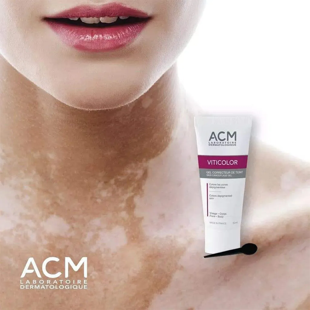 ACM Viticolor Durable Skin Camouflage Gel, Re-Pigmentation Treatment For Vitiligo 50ml